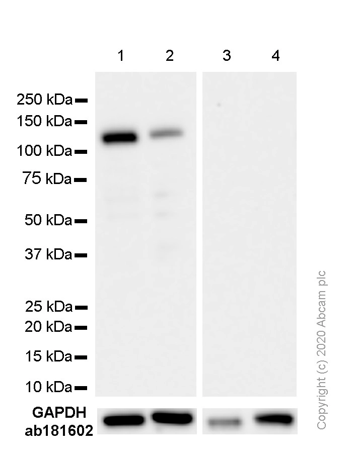 Anti-Androgen Receptor antibody [EPR1535(2)]