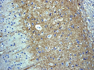 Anti-Somatostatin Receptor 2 antibody [UMB1] - C-terminal