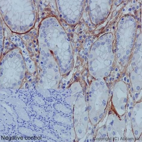 Anti-Collagen I antibody [EPR7785]