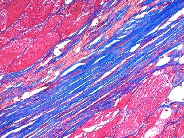 Trichrome Stain Kit (Connective Tissue Stain)