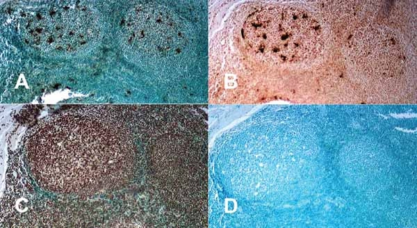 TUNEL Assay Kit - HRP-DAB