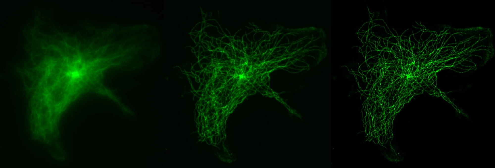 Crest Optics Deep SIM w/ X-Light Super Resolution  Confocal