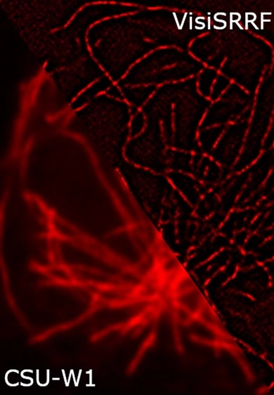 Visitron SRRF: Super Resolution Algorithm Module Microscope