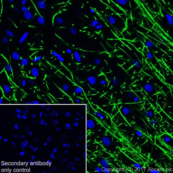 Anti-Myelin Basic Protein antibody [EPR21188]