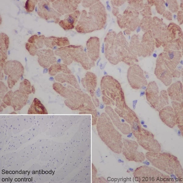 Anti-Cardiac Troponin T antibody [EPR20266]