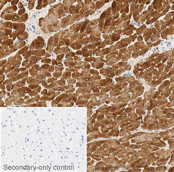 Anti-Cardiac Troponin T antibody(AB45932)