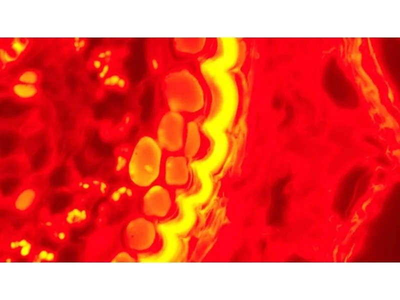 Thumbnail 24