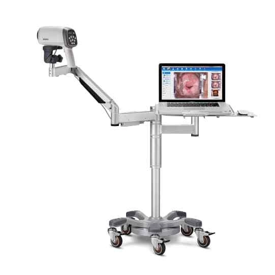 Edan C6A HD Video Colposcope