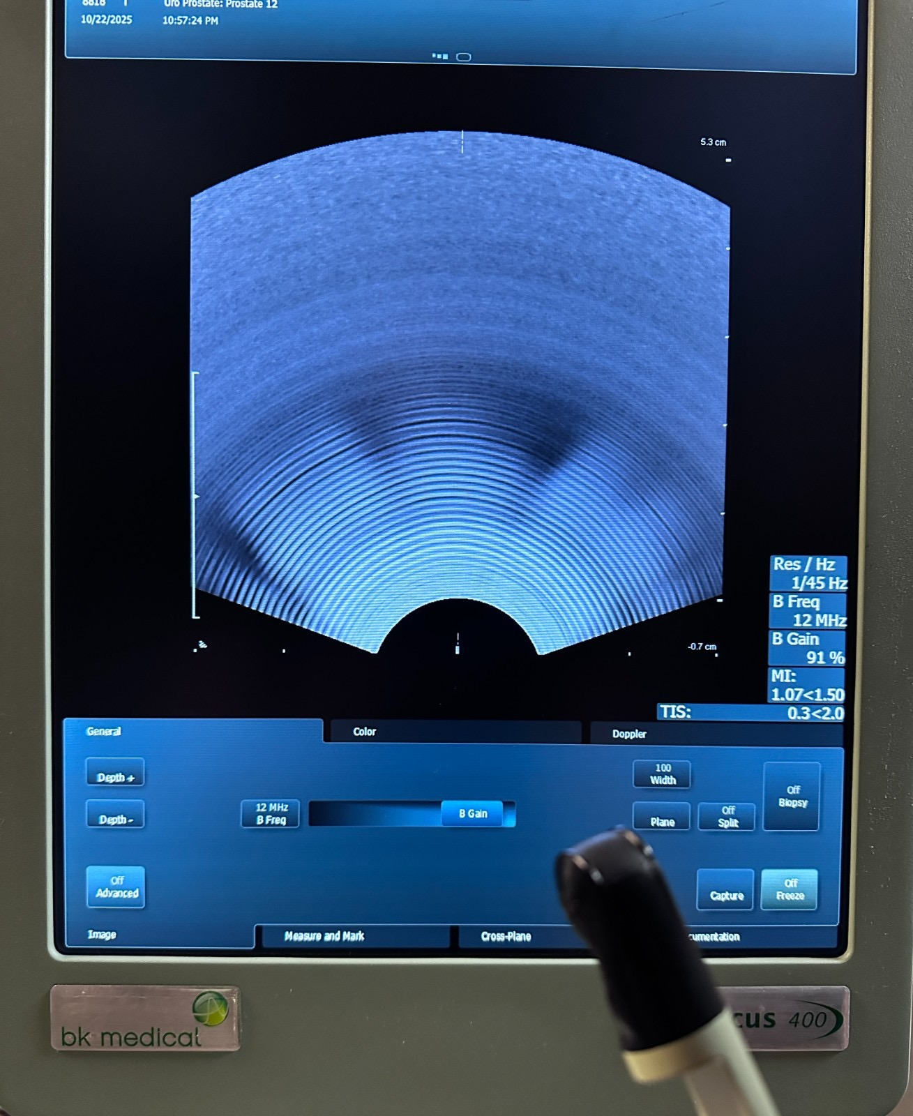 BK Medical 8818 Ultrasound Transducer Probe 12–4MHz Flex Focus 400 Tested  Noble Lab Trade