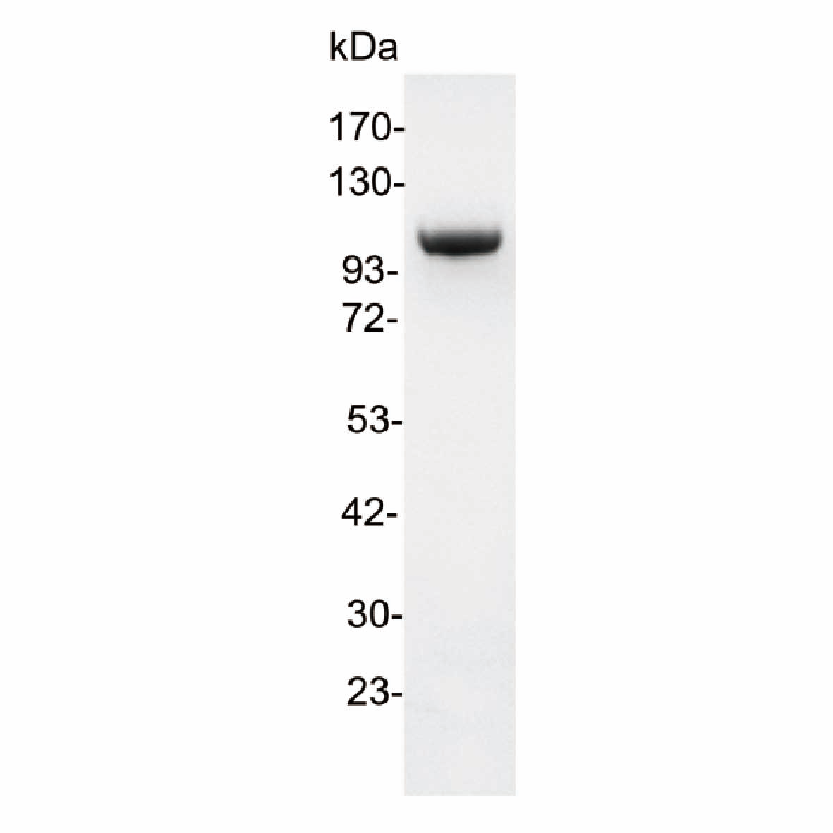 GMP T7 RNA Polymerase for mRNA & Cell and Gene Therapy Manufacturing