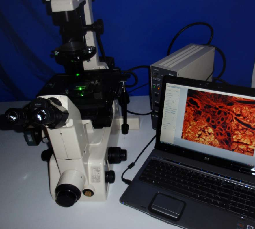 Nikon Diaphot 300 Inverted Fluorescence Phase Contrast Microscope 18MP