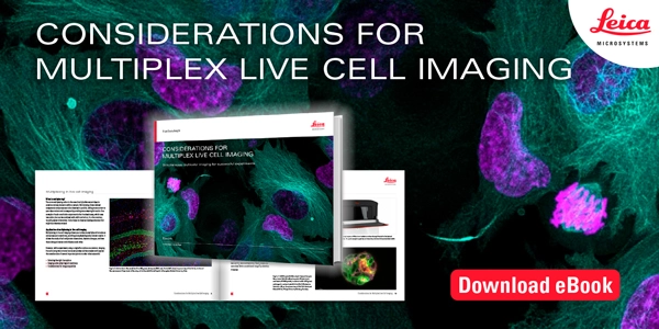 Challenges and Solutions in Multiplex Live Cell Imaging